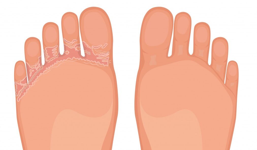 Effective Broad Band against all kinds of fungus